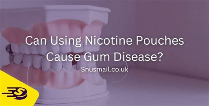 Does nicotine pouches cause gum recession? – Celebrity.fm – #1 Official Stars, Business & People Network, Wiki, Success story, Biography & Quotes