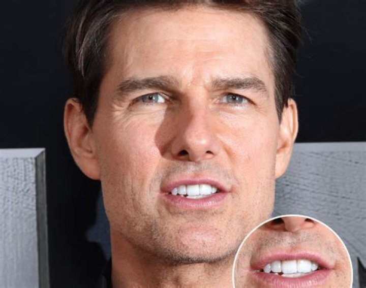 Does Tom Cruise only have one front tooth? – Celebrity.fm – #1 Official Stars, Business & People Network, Wiki, Success story, Biography & Quotes