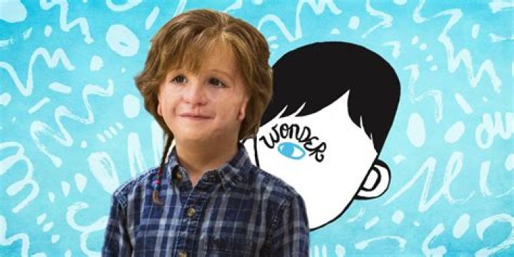 Ребёнок из Чуда на самом деле деформирован? – Celebrity.fm