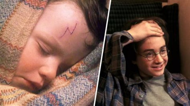 What Colour is Harry Potters scar? – Celebrity.fm – #1 Official Stars, Business & People Network, Wiki, Success story, Biography & Quotes