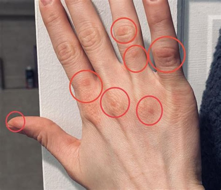 ¿Qué significa 3 puntos en tu dedo? – Celebrity.fm