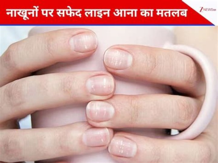 ¿Qué significa línea blanca? – Celebrity.fm