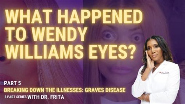 ¿Qué pasa con los ojos de Wendy Williams? – Celebrity.fm
